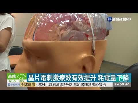 晶片助深腦刺激 提升帕金森氏症療效