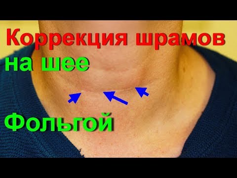 Болит поясница причины температура Стоимость операции на коленном суставе в красноярске