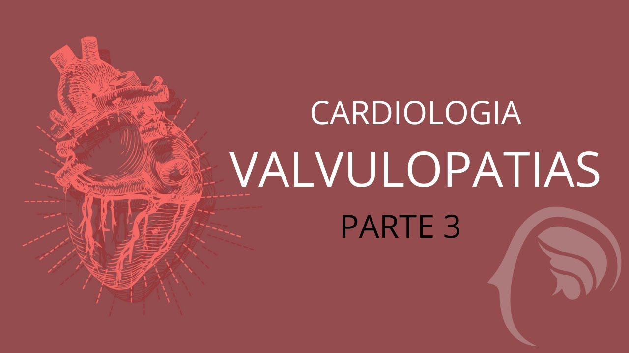 Cardiologia - Aula de Valvulopatias (Estenose Aórtica) - Parte 3