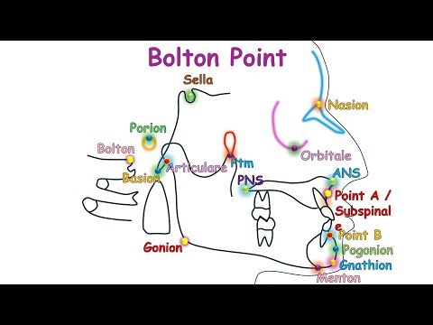 Cephalometric Landmarks (Animation)