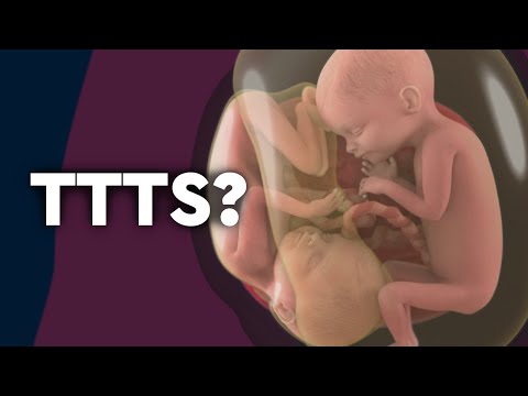 Twin-to-Twin Transfusion Syndrome and Fetoscopic Laser Surgery