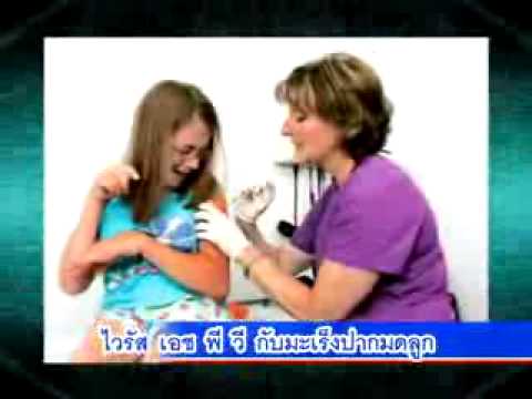 ปัญหาความแรง สมาชิกที่มีขนาดเล็กที่สุดในประวัติศาสตร์ของ