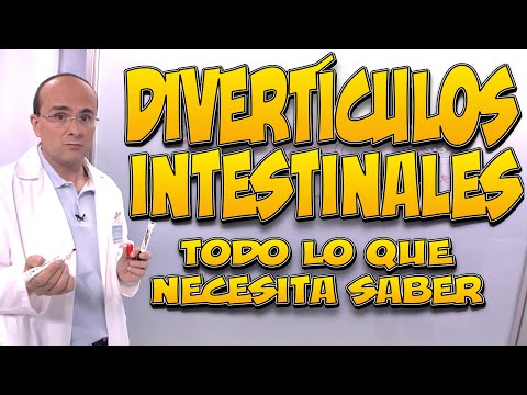 DIVERTÍCULOS INTESTINALES - Todo lo que necesita saber