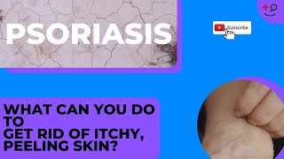 Psoriasis Treatments for You. Get Rid of That Itchy, Painful, Rash