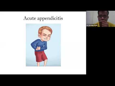 Role of polarity analysis in acute cases by  Dr Devang Shah