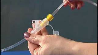 Product video: 14 Fr AMT Mini ONE Balloon Button Low Profile G-Tube