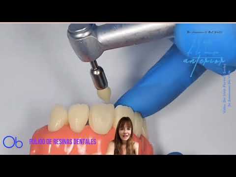 Pulido de Resinas dentales