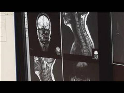 Radiology : What Is Computed Radiography?