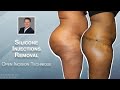 Silicone Injections Removal From The Buttocks Thighs Tibia