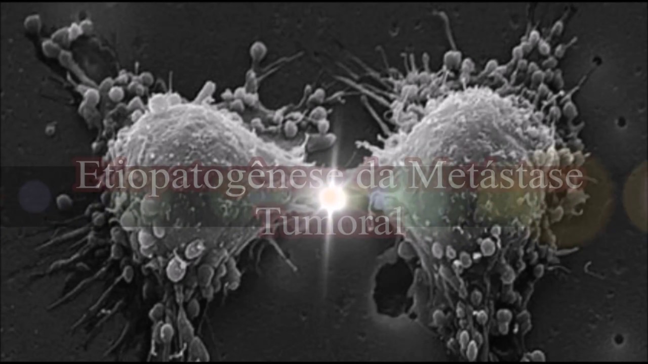 Metástase tumoral