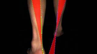 Miniature de la vidéo