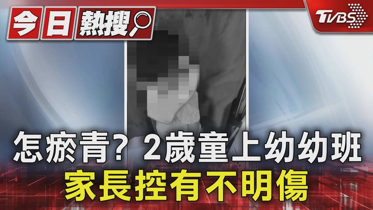 怎瘀青?2歲童上幼幼班 家長控有不明傷