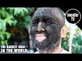 The Wolf Boy The Hairiest Man In The World