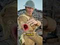 Why Soldiers Put Maggots in Their Wounds