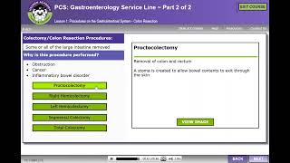 HCGTV: Course Preview - Colon Resection: Coding Excision or Resection in ICD-10-PCS