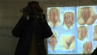 Gynacology - Dr.Nadine Alaa Sherif - Valvular Lesions    - Part 1