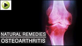 Aches & Pains - Osteoarthritis (Arthritis or Joint Pain) - Natural Ayurvedic Home Remedies