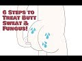 6 Ways to treat Butt Sweat, Fungus, Itching AkA Swamp Butt!