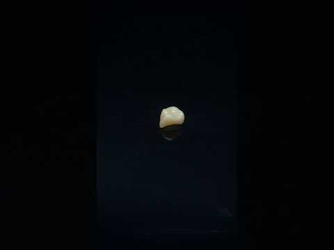 YouTube 썸네일
