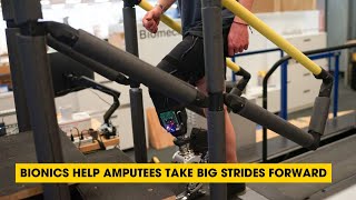 Podcast: Bionics Help Amputees Take Big Strides Forward