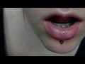 vertical labret - hole - scar tissue [I don't have this ...