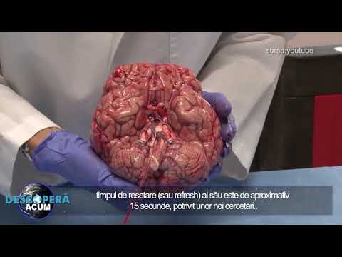 Cat timp ii ia creierului uman sa-si dea refresh si ce s-ar intampla daca nu ar face asta?