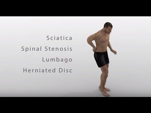 download lagu mp3 mp4 Vertetrac For Sale, download lagu Vertetrac For Sale gratis, unduh video klip Vertetrac For Sale