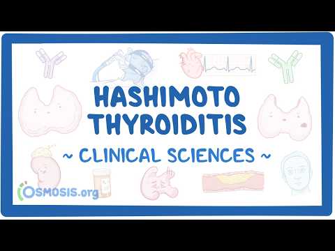 橋本病 (Hashimoto thyroiditis)