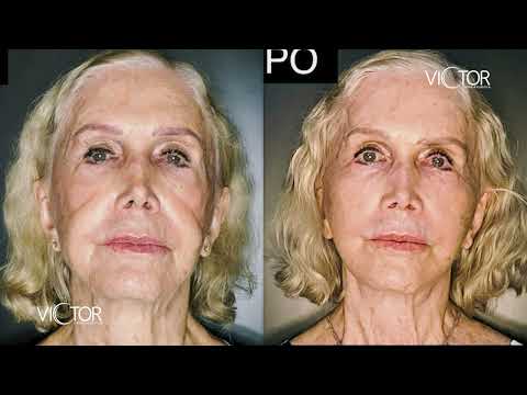 TV | DR LEONARDO VICTOR