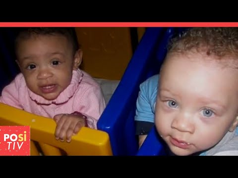 Sie sind Zwillinge, aber sie haben eine andere Hautfarbe