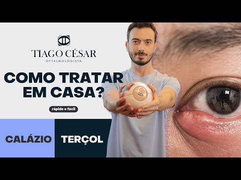 Calázio ou Terçol no Olho: Como tratar e curar em casa? DESCUBRA AGORA