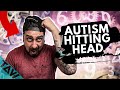 Do YOU Hit Your Head Autism And Self Harm