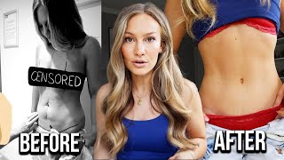 My Plastic Surgery Story!