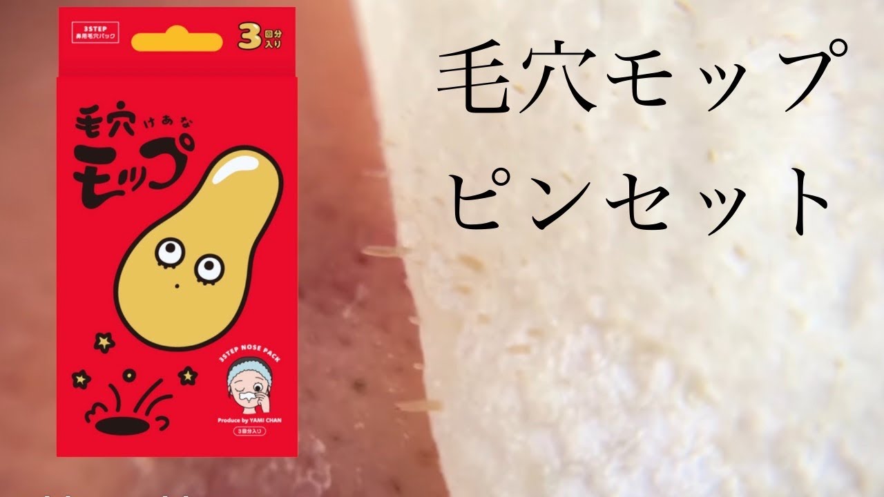 毛穴モップ（YAMMY’S TOY）vs角栓丸