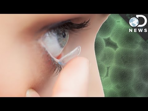 愛戴隱形眼鏡嗎?小心傷了眼睛! (Are Contact Lenses Damaging Your Eyes?)