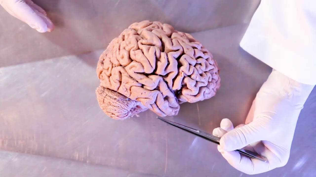 02 Introdução ao Telencéfalo - neuroanatomia na prática