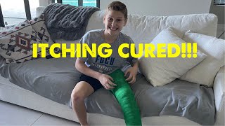 How to get rid of itching under the cast (This helps a lot)