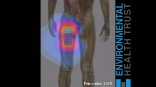 Mobile Phone in Pocket Exposes Reproductive Organs to Radiation