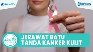 Jangan Asal Pencet! Jerawat Batu yang Tak Kunjung Hilang Bisa Jadi Kanker Kulit, Ini Tandanya