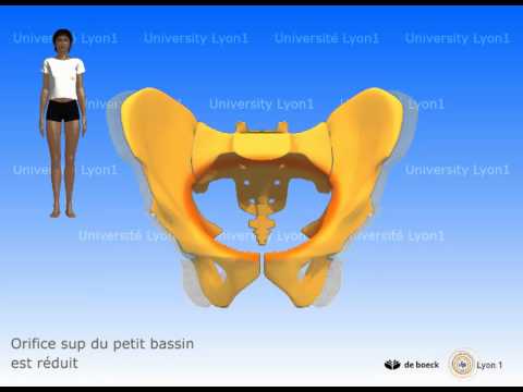 comment soulager fracture coccyx