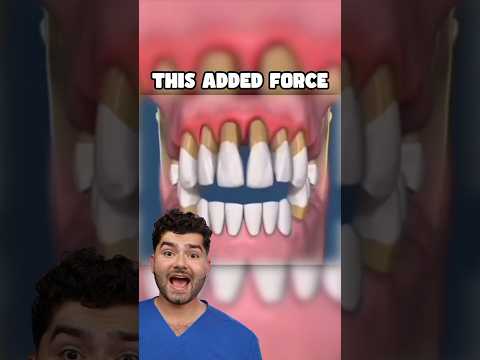 What Would Happen If You Stop Brushing Your Teeth!?