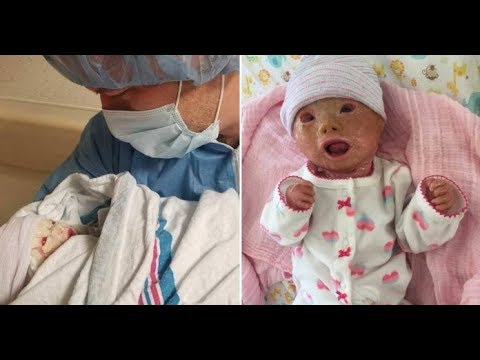 Elle a eu une césarienne d'urgence 34 semaines, le papa prend le bébé et tout le monde était au choc Video