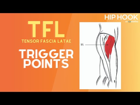 TFL Trigger Point Release - How to Release the Tensor Fascia Latae Muscle.