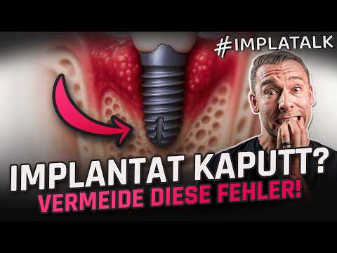 How to care for implants properly – your ultimate guide