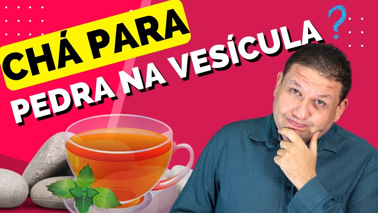 CHÁ PARA PEDRA NA VESÍCULA? EXISTE ? Porque não usar medicação para expulsar a pedra na vesícula.