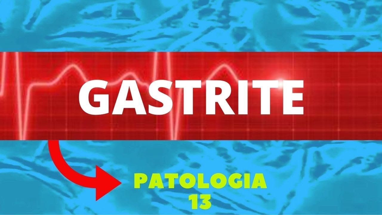 GASTRITE  - ENTENDA A GASTRITE -  PATOLOGIA - AULA 13