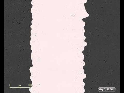 MeT5A 25 μM Genistein treatment