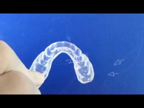 SleepPro Standard Night Guard