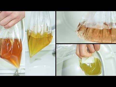 ✅ Oto, co kolor twojego moczu, mówi o twoim stanie zdrowia...