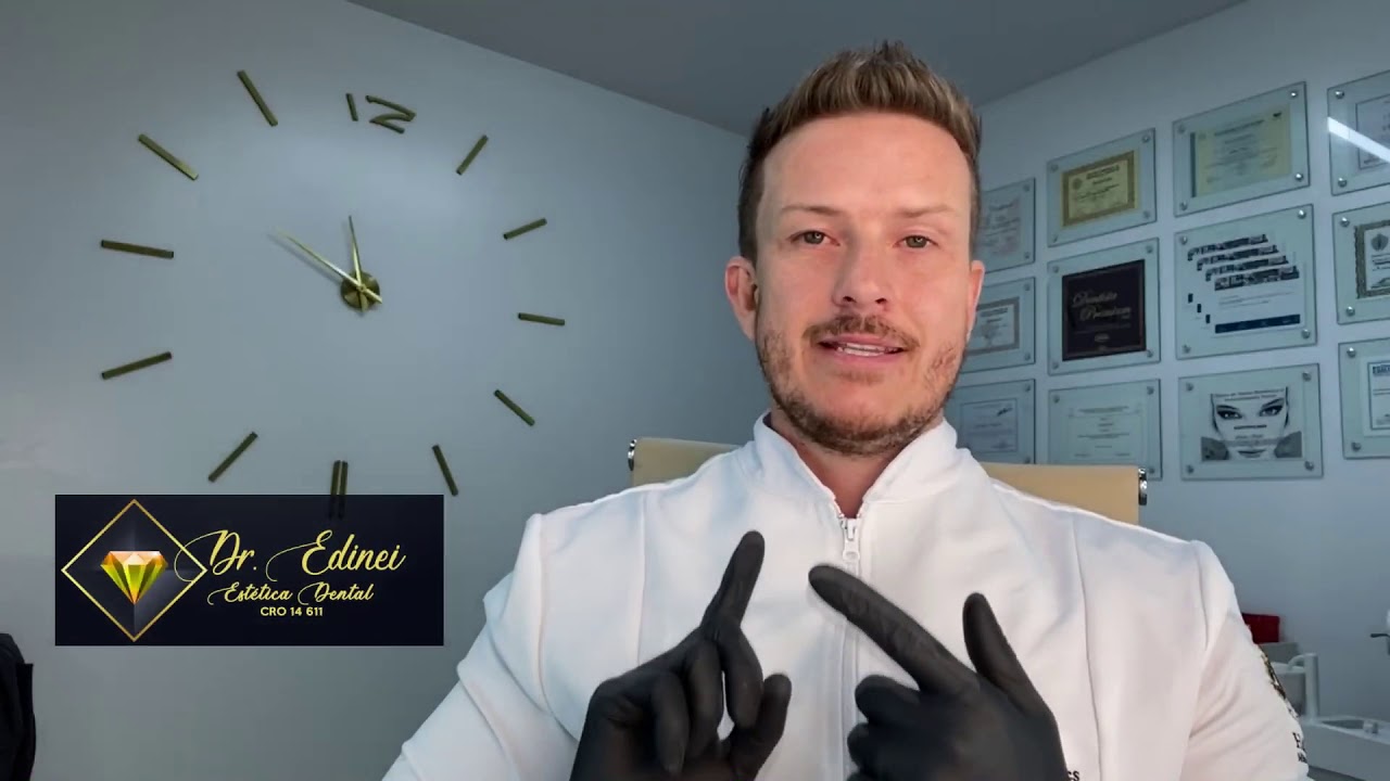 Clareamento Caseiro - Dúvidas, dicas e procedimentos